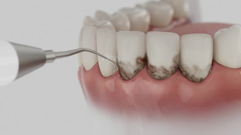 Reliable Dental contractor in Springfield, NE by Smile Center Dentistry